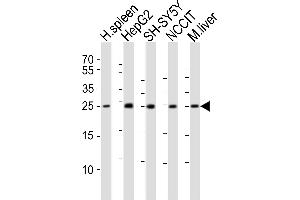 Western blot analysis of lysates from human spleen tissue lysate, HepG2, SH-SY5Y, NCCIT cell line, mouse liver tissue lysate (from left to right), using MIXL1 Antibody (C-term) (ABIN6243884 and ABIN6577779).