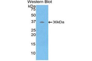 Western Blotting (WB) image for anti-ATPase, H+ Transporting, Lysosomal Accessory Protein 2 (ATP6AP2) (AA 17-302) antibody (ABIN3203347)