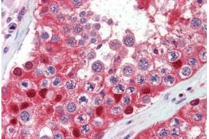 Testis, Human: Formalin-Fixed, Paraffin-Embedded (FFPE) (Ubiquitin Antikörper)