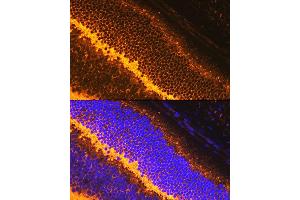 Immunofluorescence (IF) image for anti-Synaptophysin (SYP) (AA 150-250) antibody (ABIN6148783)