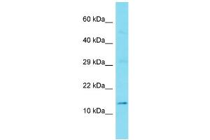 Western Blotting (WB) image for anti-Gilles De La Tourette Syndrome Chromosome Region, Candidate 1 (GTSCR1) (N-Term) antibody (ABIN2791569) (GTSCR1 Antikörper  (N-Term))