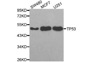Western blot analysis of extracts of various cell lines, using TP53 antibody. (p53 Antikörper)
