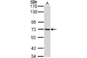 WB Image Sample (30 ug of whole cell lysate) A: Molt-4 , 7. (C1R Antikörper)