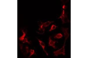 ABIN6274450 staining COLO205 cells by IF/ICC. (MADD Antikörper  (Internal Region))