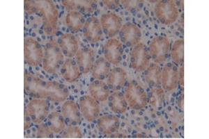 Detection of b2M in Mouse Kidney Tissue using Monoclonal Antibody to Beta-2-Microglobulin (b2M) (beta-2 Microglobulin Antikörper  (AA 22-119))