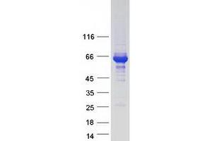 Validation with Western Blot (RNF25 Protein (Myc-DYKDDDDK Tag))