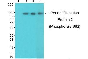 Western blot analysis of extracts from 3T3lbnotHeLa and K562 cells, using Period Circadian Protein 2 (Phospho-Ser662) Antibody. (PER2 Antikörper  (pSer662))