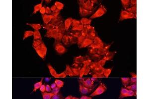 Immunofluorescence analysis of HeLa cells using AOC1 Polyclonal Antibody at dilution of 1:100 (40x lens). (DAO Antikörper)