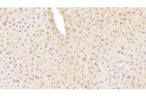 Detection of TREM1 in Mouse Liver Tissue using Polyclonal Antibody to Triggering Receptor Expressed On Myeloid Cells 1 (TREM1) (TREM1 Antikörper  (AA 21-230))