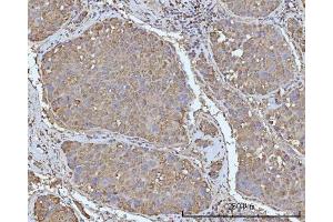 IHC analysis of OCRL using anti-OCRL antibody (ABIN7599572). (OCRL Antikörper  (AA 1-901))