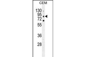CLCN7 Antibody (C-term) (ABIN655808 and ABIN2845235) western blot analysis in CEM cell line lysates (35 μg/lane).