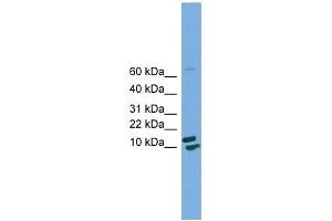 PPIH antibody used at 1 ug/ml to detect target protein. (PPIH Antikörper)