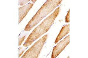 (ABIN6243464 and ABIN6578057) staining Htr2a in mouse skeletal muscle sections by Immunohistochemistry (IHC-P - paraformaldehyde-fixed, paraffin-embedded sections). (HTR2A Antikörper  (N-Term))