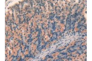 IHC-P analysis of Mouse Stomach Tissue, with DAB staining. (SERPINA7 Antikörper  (AA 127-393))