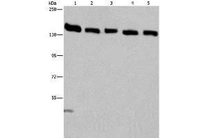 Western Blot analysis of Hela cell and Human testis tissue, A549, Jurkat and K562 cell using IPO4 Polyclonal Antibody at dilution of 1:550 (Importin 4 Antikörper)