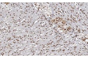 ABIN6266862 at 1/100 staining human Smooth muscle tissue sections by IHC-P. (MAPKAP Kinase 3 Antikörper  (C-Term))
