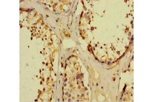 Immunohistochemistry (IHC) image for anti-Nuclear Receptor Subfamily 1, Group I, Member 3 (NR1I3) (AA 2-351) antibody (ABIN7161898)