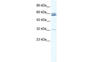 Western Blotting (WB) image for anti-Zinc Finger Protein 491 (ZNF491) antibody (ABIN2461306) (ZNF491 Antikörper)