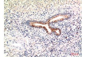 Immunohistochemistry (IHC) analysis of paraffin-embedded Human Liver, antibody was diluted at 1:100. (Complement C4A/C4B (Internal Region) Antikörper)