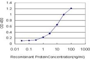 Detection limit for recombinant GST tagged HGD is approximately 0. (HGD Antikörper  (AA 377-445))