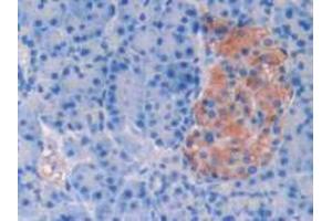 IHC-P analysis of Human Pancreas Tissue, with DAB staining. (SERPINA6 Antikörper  (AA 218-378))
