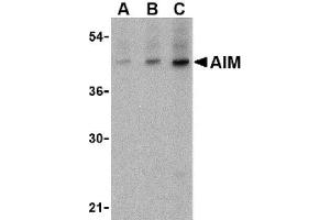 Image no. 1 for anti-CD5 Molecule-Like (CD5L) (C-Term) antibody (ABIN265124) (CD5L Antikörper  (C-Term))