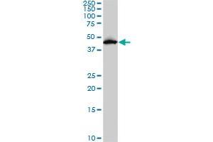 PDK2 monoclonal antibody (M02), clone 5F8. (PDK2 Antikörper  (AA 187-276))