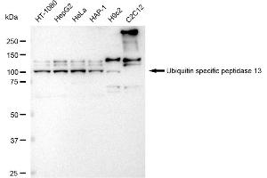 Western blotting analysis using Ubiquitin specific peptidase 13 antibody (ABIN7800726).
