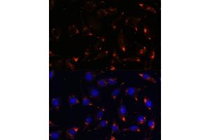 Immunofluorescence analysis of L929 cells using NOS1 antibody (ABIN6129512, ABIN6144725, ABIN6144726 and ABIN6216548) at dilution of 1:100. (NOS1 Antikörper  (AA 1-180))