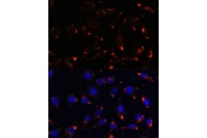Immunofluorescence analysis of L929 cells using NOS1 antibody (ABIN6129512, ABIN6144725, ABIN6144726 and ABIN6216548) at dilution of 1:100. (NOS1 Antikörper  (AA 1-180))