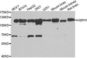 Western blot analysis of extracts of various cell lines, using HSPH1 antibody. (HSPH1 Antikörper)