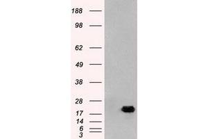 Image no. 1 for anti-Adenylate Kinase 1 (AK1) antibody (ABIN1496516)