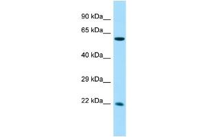 Host: Rabbit Target Name: CCDC85A Sample Type: Fetal Liver lysates Antibody Dilution: 1. (CCDC85A Antikörper  (N-Term))