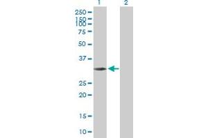 Western Blot analysis of NMRAL1 expression in transfected 293T cell line by NMRAL1 MaxPab polyclonal antibody. (NMRAL1 Antikörper  (AA 1-299))