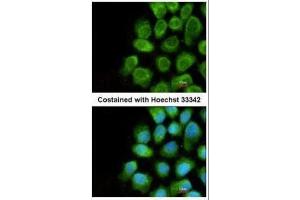 ICC/IF Image Immunofluorescence analysis of methanol-fixed A431, using COX5A, antibody at 1:200 dilution. (COX5A Antikörper  (Center))