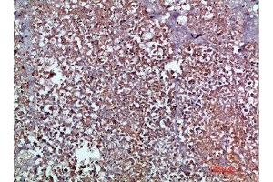 Immunohistochemical analysis of paraffin-embedded human-pancreas, antibody was diluted at 1:200 (CCL2 Antikörper  (AA 31-80))