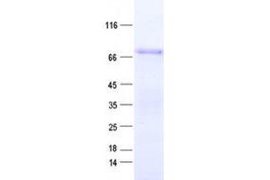ZNF317 Protein (His tag)