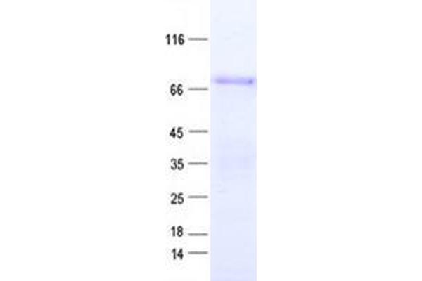 ZNF317 Protein (His tag)