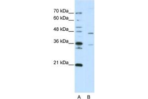 Western Blotting (WB) image for anti-Zinc Finger Protein 488 (ZNF488) antibody (ABIN2462000) (ZNF488 Antikörper)