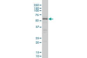 Western Blotting (WB) image for anti-CAMP Responsive Element Binding Protein 5 (CREB5) (AA 1-100) antibody (ABIN599087) (CREB5 Antikörper  (AA 1-100))