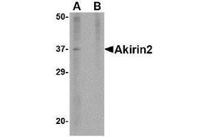 Western blot analysis of Akirin2 in mouse brain tissue lysate with AP30040PU-N Akirin2 antibody at 1 μg/ml in (A) the absence and (B) the presence of blocking peptide.