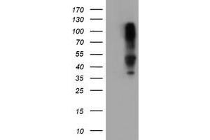 Image no. 1 for anti-serpin Peptidase Inhibitor, Clade B (Ovalbumin), Member 1 (SERPINB1) (AA 77-306) antibody (ABIN1491672) (SERPINB1 Antikörper  (AA 77-306))