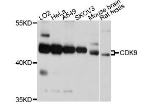 Western blot analysis of extracts of various cell lines, using CDK9 antibody. (CDK9 Antikörper)