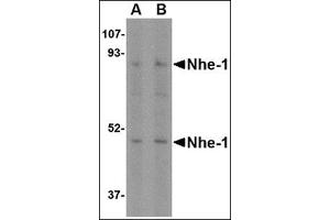 Western blot analysis of Nhe-1 in MOLT4 cell lysate with this product at (A) 1 and (B) 2 μg/ml. (SLC9A1 Antikörper  (Center))