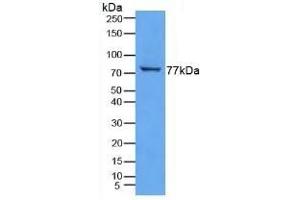 TGM3 anticorps  (AA 468-693)