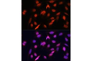 Immunofluorescence analysis of U2OS cells using OTUB1 antibody (ABIN6128400, ABIN6145086, ABIN6145088 and ABIN6215346) at dilution of 1:100. (OTUB1 Antikörper  (AA 1-220))