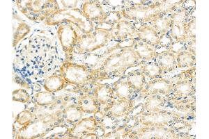 ABIN6257368 and ABIN6275745 at 1/100 staining Rat kidney tissue by IHC-P.