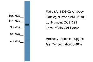 WB Suggested Anti-DGKQ  Antibody Titration: 0. (DGKQ Antikörper  (Middle Region))