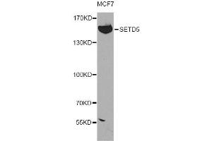 Western blot analysis of extracts of MCF-7 cells, using SETD5 antibody (ABIN4905135) at 1:300 dilution. (SETD5 Antikörper)