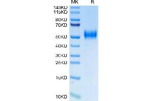SDS-PAGE (SDS) image for Plasminogen Activator, Urokinase Receptor (PLAUR) (AA 23-305) protein (His-Avi Tag,Biotin) (ABIN7275408)